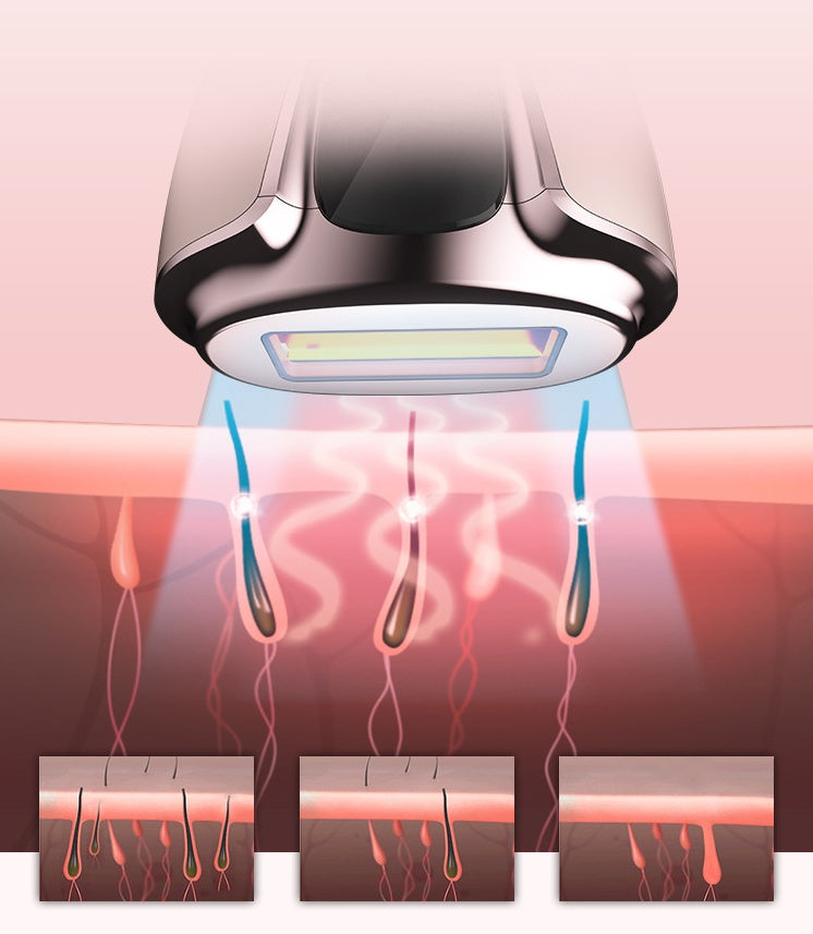 LumiSmooth Home Laser Hair Removal Device