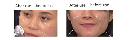 GlowPulse Electroporation Device
