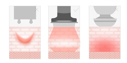 GlowPulse Electroporation Device